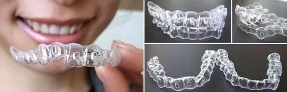这几种牙齿矫正后能改变脸型和嘴型！